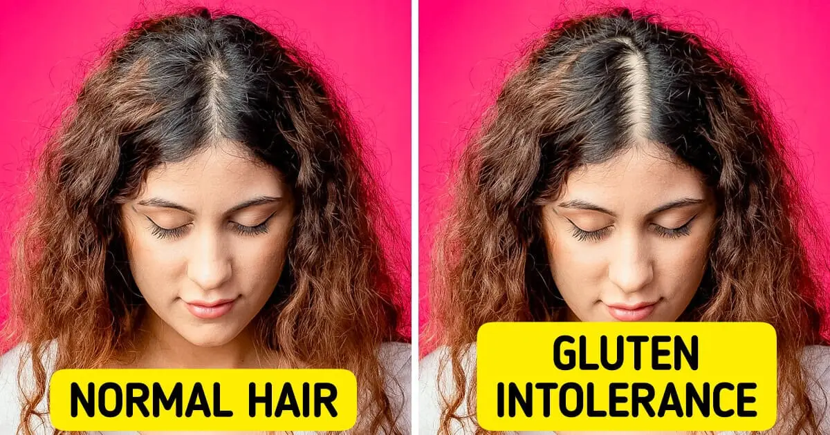 13 Strange Ways Your Body May Be Reacting to Gluten