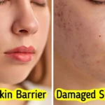 8 Warning Signs Your Skin Barrier Might Be Damaged