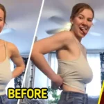 Woman Documents Her Breast Reduction Surgery, and Shocks Everyone With the Results